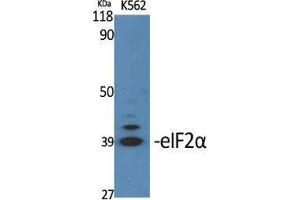 Western Blot (WB) analysis of specific cells using eIF2alpha Polyclonal Antibody. (EIF2A 抗体  (Ser326))