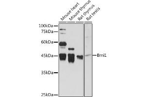 Western blot analysis of extracts of various cell lines, using Bmi1 Rabbit pAb (ABIN3020690, ABIN3020691, ABIN3020692 and ABIN6213671) at 1:5000 dilution.