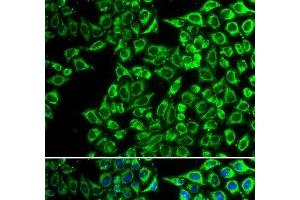 Immunofluorescence analysis of A549 cells using LIPC Polyclonal Antibody (LIPC 抗体)