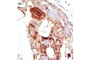 Image no. 2 for anti-SUMO1/sentrin Specific Protease 6 (SENP6) (C-Term) antibody (ABIN356759) (SENP6 抗体  (C-Term))