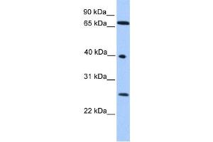 Western Blotting (WB) image for anti-Lethal(3) Malignant Brain Tumor-Like Protein 2 (L3MBTL2) antibody (ABIN2457889) (L3MBTL2 抗体)