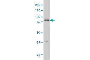 RIPK4 monoclonal antibody (M01), clone 2G3 Western Blot analysis of RIPK4 expression in A-431 . (RIPK4 抗体  (AA 675-784))