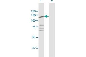 Western Blotting (WB) image for anti-Protein tyrosine Phosphatase, Receptor Type, N Polypeptide 2 (PTPRN2) (AA 1-986) antibody (ABIN948358)