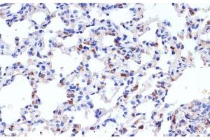 Immunohistochemistry (Paraffin-embedded Sections) (IHC (p)) image for anti-Surfactant Protein C (SFTPC) antibody (ABIN7259843)