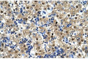 Human Liver (CTP Synthase 抗体  (N-Term))