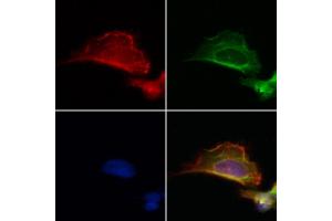 ABIN6264426 and ABIN6272879 staining Hela by IF/ICC. (PRKCDBP 抗体  (Internal Region))