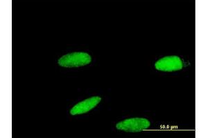 Immunofluorescence of monoclonal antibody to ZNF587 on HeLa cell. (ZNF587 抗体  (AA 1-122))