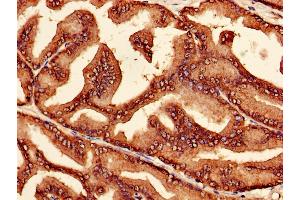 Immunohistochemistry (IHC) image for anti-Proteasome (Prosome, Macropain) Subunit, beta Type, 7 (PSMB7) (AA 44-275) antibody (ABIN7164986)