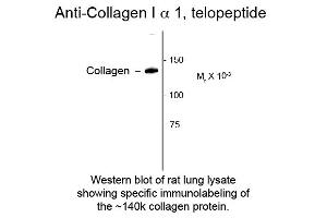 Western Blotting (WB) image for anti-Collagen, Type I, alpha 1 (COL1A1) (C-Term) antibody (ABIN6657341)