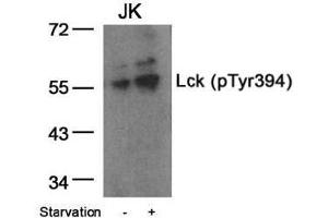 Image no. 1 for anti-Lymphocyte-Specific Protein tyrosine Kinase (LCK) (pTyr394) antibody (ABIN196861) (LCK 抗体  (pTyr394))