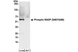 Western Blotting (WB) image for anti-Wiskott-Aldrich Syndrome (Eczema-thrombocytopenia) (WAS) (pSer483), (pSer484) antibody (ABIN7449174)