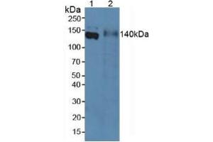 Western blot analysis of (1) Rat Serum and (2) Rat Intestine Tissue. (Emilin1 抗体  (AA 684-899))