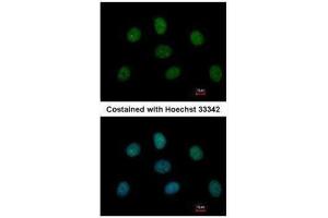 Immunofluorescence (IF) image for anti-Proteasome (Prosome, Macropain) 26S Subunit, Non-ATPase, 14 (PSMD14) (Center) antibody (ABIN2856031)