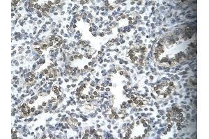 Immunohistochemistry (IHC) image for anti-Transcription Elongation Factor SPT5 (SUPT5H) (C-Term) antibody (ABIN2777903)