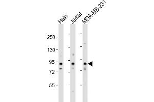 Western Blotting (WB) image for anti-Myb-Like, SWIRM and MPN Domains 1 (MYSM1) (AA 111-139), (N-Term) antibody (ABIN654474)