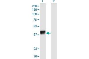 Western Blot analysis of HNRNPC expression in transfected 293T cell line by HNRNPC monoclonal antibody (M02), clone 4E8.