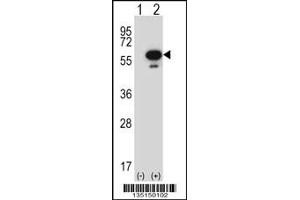 Western blot analysis of Stk25 using rabbit polyclonal Mouse Stk25 Antibody using 293 cell lysates (2 ug/lane) either nontransfected (Lane 1) or transiently transfected (Lane 2) with the Stk25 gene. (STK25 抗体  (C-Term))
