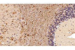 Immunohistochemistry (IHC) image for anti-Glial Fibrillary Acidic Protein (GFAP) (AA 108-211) antibody (ABIN7441994)