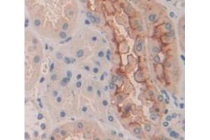 IHC-P analysis of Human Tissue, with DAB staining. (DOCK1 抗体  (AA 1200-1435))