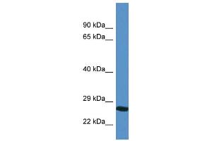 WB Suggested Anti-YIPF4 AntibodyTitration: 1. (YIPF4 抗体  (N-Term))