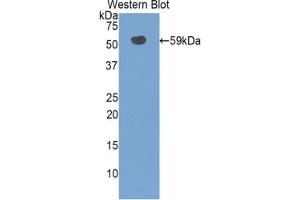 Western Blotting (WB) image for anti-Solute Carrier Family 3 (Activators of Dibasic and Neutral Amino Acid Transport), Member 2 (SLC3A2) (AA 282-523) antibody (ABIN7439168)