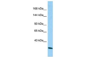 Host: Rabbit Target Name: CAPRIN2 Sample Type: A549 Whole Cell lysates Antibody Dilution: 1. (CAPRIN2 抗体  (N-Term))