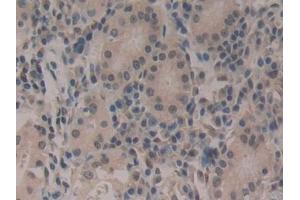 Detection of CIRBP in Human Stomach Tissue using Polyclonal Antibody to Cold Inducible RNA Binding Protein (CIRBP)