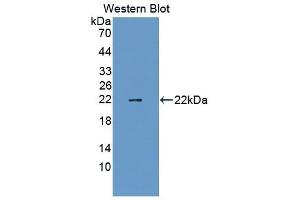 Detection of Recombinant TAZ, Mouse using Polyclonal Antibody to Tafazzin (TAZ) (TAZ 抗体  (AA 46-240))