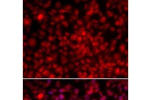Immunofluorescence analysis of U2OS cells using ILF2 Polyclonal Antibody (ILF2 抗体)