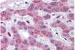 Human Liver: Formalin-Fixed, Paraffin-Embedded (FFPE) (Transmembrane Protein 18 (TMM18) (C-Term) 抗体)