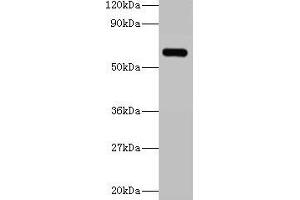 Western blot All lanes: YARS antibody at 2 μg/mL + 293T whole cell lysate Secondary Goat polyclonal to rabbit IgG at 1/15000 dilution Predicted band size: 60 kDa Observed band size: 60 kDa (YARS 抗体  (AA 2-528))
