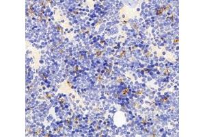Immunohistochemistry analysis of paraffin-embedded mouse bone using,FCN1 (ABIN7073952) at dilution of 1: 3000 (FCN1 抗体)