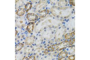 Immunohistochemistry of paraffin-embedded mouse kidney using CASP3 antibody (ABIN5997372) at dilution of 1/100 (40x lens). (Caspase 3 抗体)