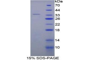 SDS-PAGE analysis of Rat Thrombin Protein. (SERPINC1 蛋白)