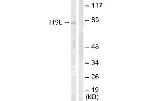 Immunohistochemistry analysis of paraffin-embedded human breast carcinoma tissue using HSL (Ab-554) antibody. (LIPE 抗体  (Ser554))