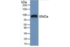 Western Blotting (WB) image for Hypoxia Inducible Factor 1, alpha Subunit (Basic Helix-Loop-Helix Transcription Factor) (HIF1A) ELISA Kit (ABIN6574209)