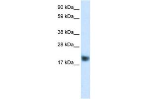 WB Suggested Anti-CSRP3 Antibody Titration:  0. (CSRP3 抗体  (C-Term))