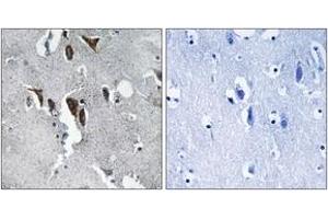 Immunohistochemistry analysis of paraffin-embedded human brain tissue, using ELOVL5 Antibody. (ELOVL5 抗体  (AA 250-299))