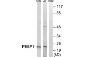 Western blot analysis of extracts from Jurkat/K562 cells, using PEBP1 Antibody. (PEBP1 抗体  (AA 105-154))