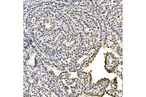 IHC analysis of SSB using anti-SSB antibody (ABIN7602125). (SSB 抗体  (AA 6-283))