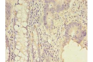 Immunohistochemistry (IHC) image for anti-Sodium Channel, Nonvoltage-Gated 1, gamma (SCNN1G) (AA 90-350) antibody (ABIN7143981)