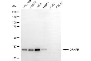 Western blotting analysis using GRHPR antibody (ABIN7798786). (GRHPR 抗体)