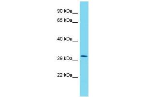 Western Blotting (WB) image for anti-Muscular LMNA-Interacting Protein (MLIP) (N-Term) antibody (ABIN2791247) (MLIP 抗体  (N-Term))