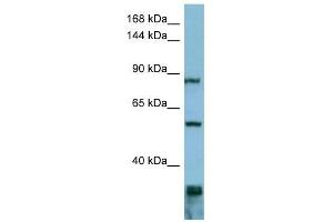 EPS8 antibody used at 1 ug/ml to detect target protein. (EPS8 抗体  (Middle Region))