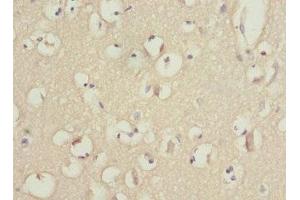 Immunohistochemistry of paraffin-embedded human brain tissue using ABIN7163172 at dilution of 1:100