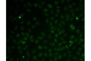 Immunofluorescence analysis of MCF7 cells using RC antibody (ABIN6132580, ABIN6146644, ABIN6146647 and ABIN6216132). (RAD51C 抗体  (AA 1-135))
