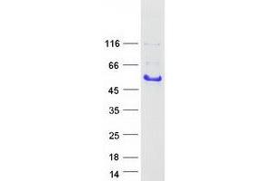 Validation with Western Blot (GAP43 Protein (Transcript Variant 2) (Myc-DYKDDDDK Tag))