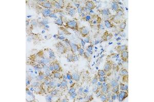 Immunohistochemistry (IHC) image for anti-Proteasome (Prosome, Macropain) 26S Subunit, Non-ATPase, 10 (PSMD10) (AA 1-226) antibody (ABIN1682352)