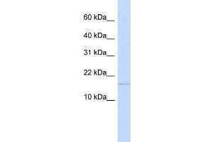 WB Suggested Anti-C3orf18 Antibody Titration:  0. (C3orf18 抗体  (N-Term))