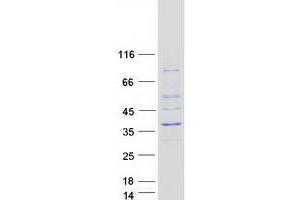 Western Blotting (WB) image for Achaete-Scute Complex Homolog 1 (Drosophila) (ASCL1) protein (Myc-DYKDDDDK Tag) (ABIN2714974)